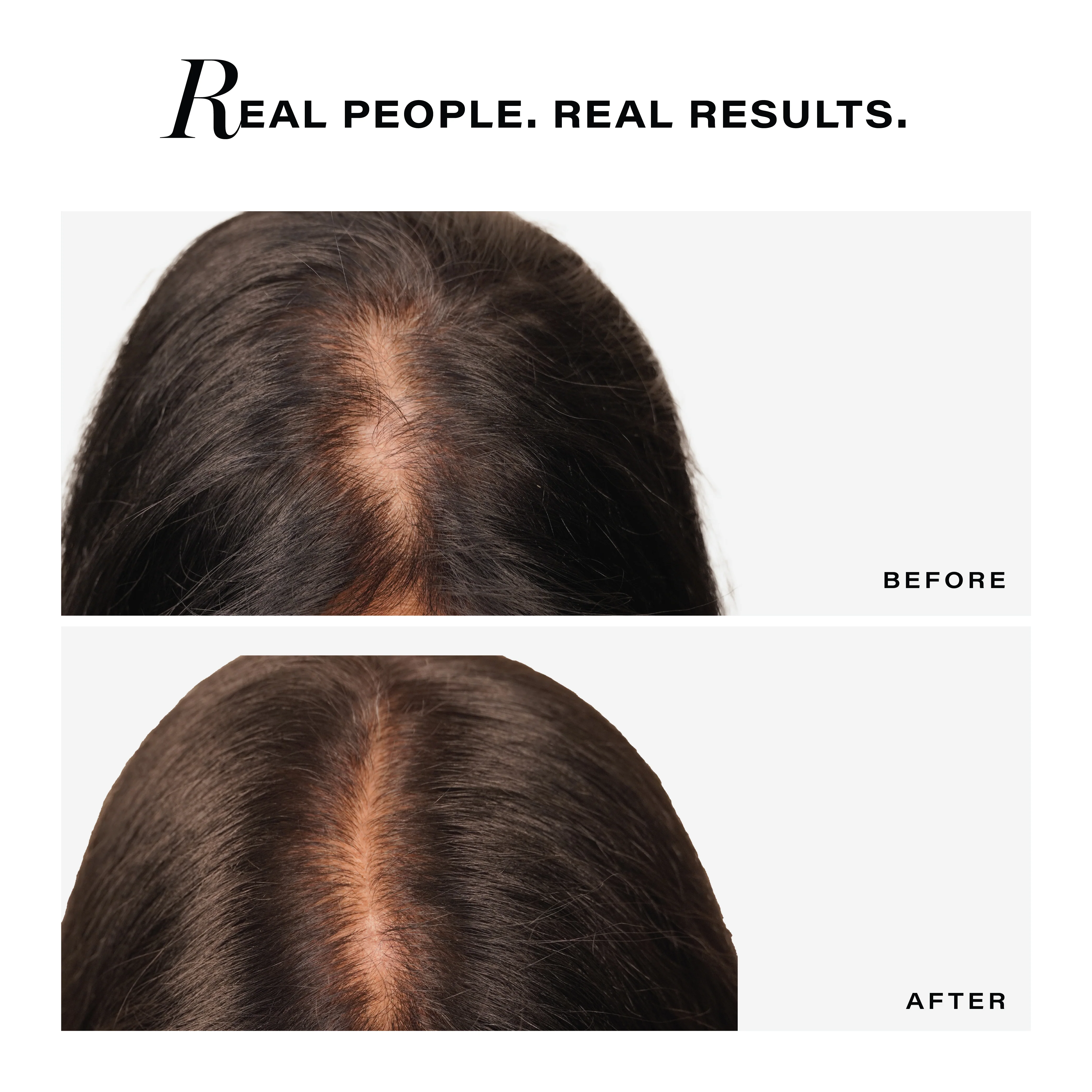 Follicle Revive Scalp Serum for Hair Growth, 50ml - Image 8