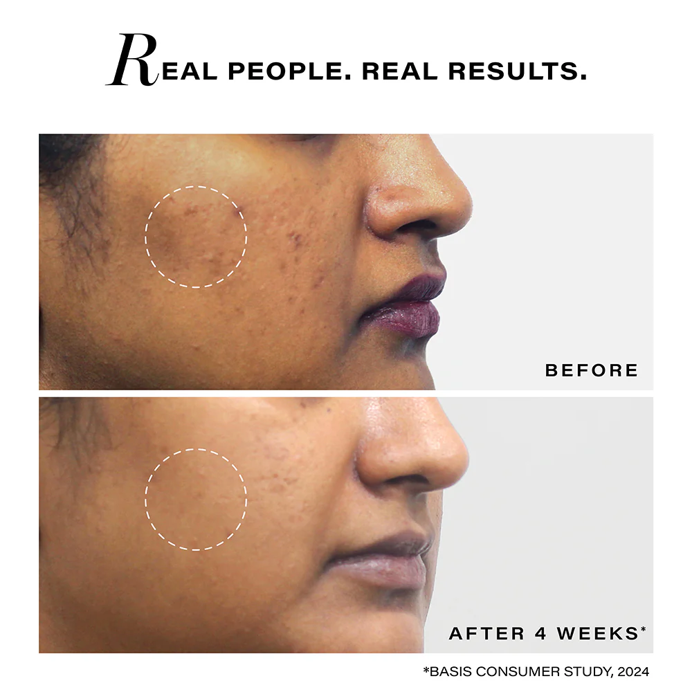 Pigmentation Reduction Moisturizer, 50g - Image 6